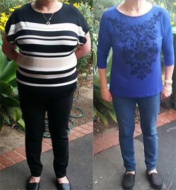 Before and After