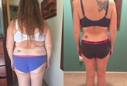 before and after
