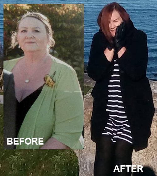 Hayley before and after